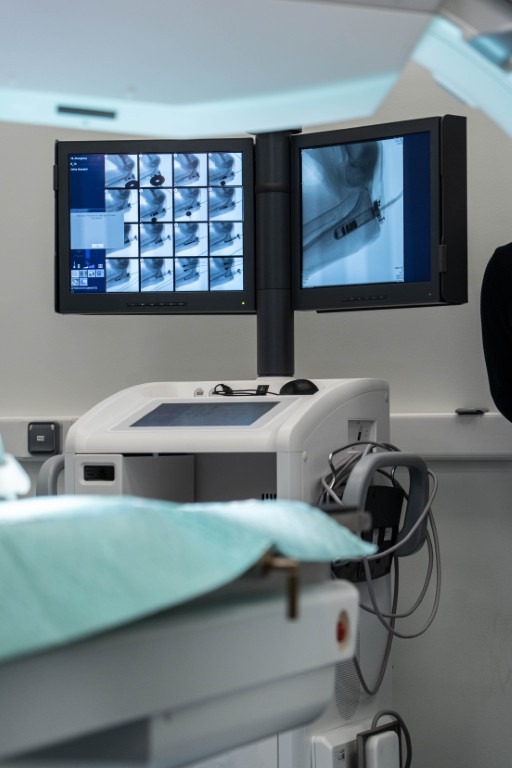 Salle d’examen médical équipée d’un appareil d’imagerie, avec deux écrans affichant des images radiographiques et une table d’intervention au premier plan.