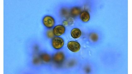 DynAlgue : premiers pas vers la sélection de microalgues à fort potentiel